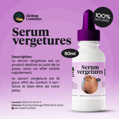 Sérum vergeture